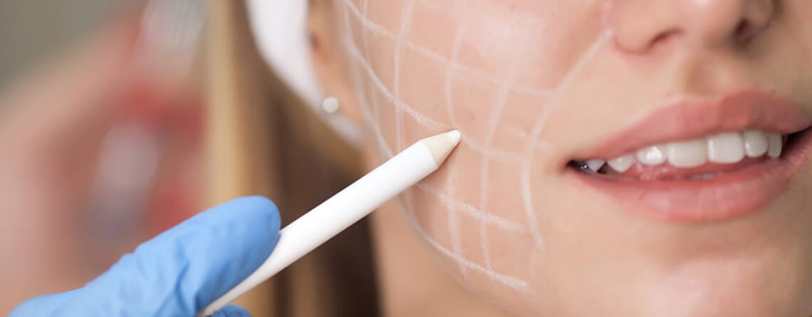 Buccal Pad Fat Removal Procedure