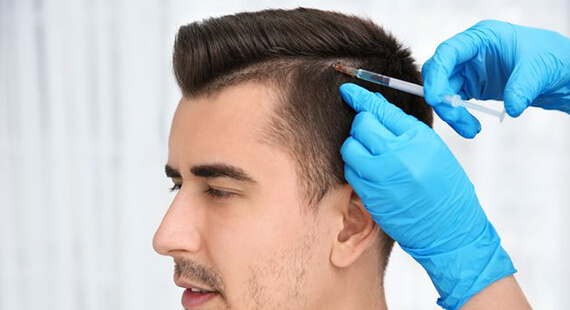 Hair Transplant in Delhi