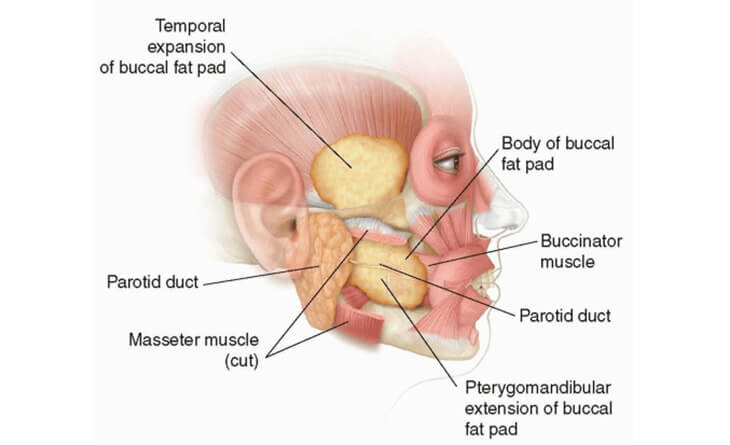 Buccal Pad Fat Removal Procedure