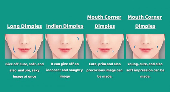 Dimple Creation Surgery in Delhi