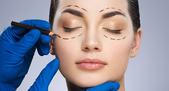 Asian Blepharoplasty in Delhi