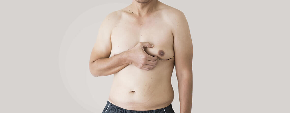 Male breast reduction surgery