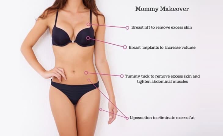 Mommy Makeover Technique