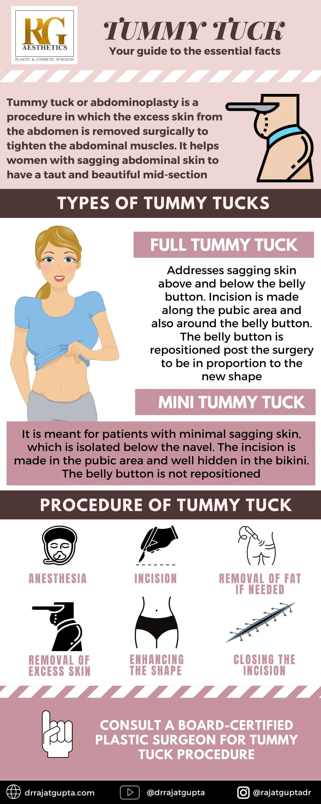 Case Study: Tummy Tuck for the Double Roll Abdominal Deformity - Explore  Plastic Surgery