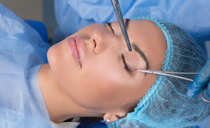 Blepharoplasty in Delhi