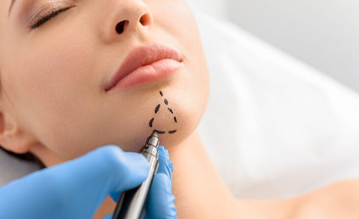 chin augmentation surgery in delhi