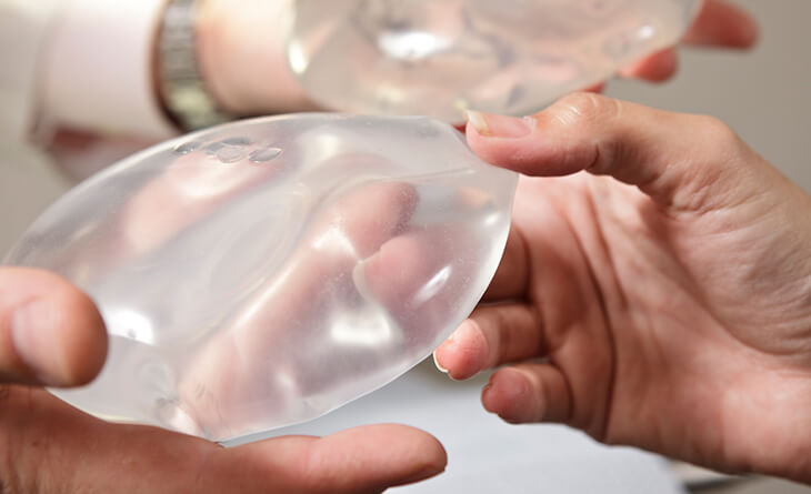 breast implants in delhi