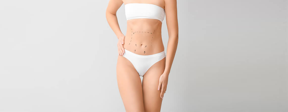 liposuction surgery in delhi