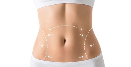 What to Expect When Searching for “Tummy Tuck Prices Near Me”
