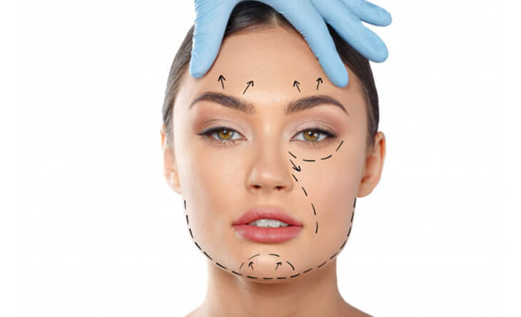 Facelift Surgery Procedure