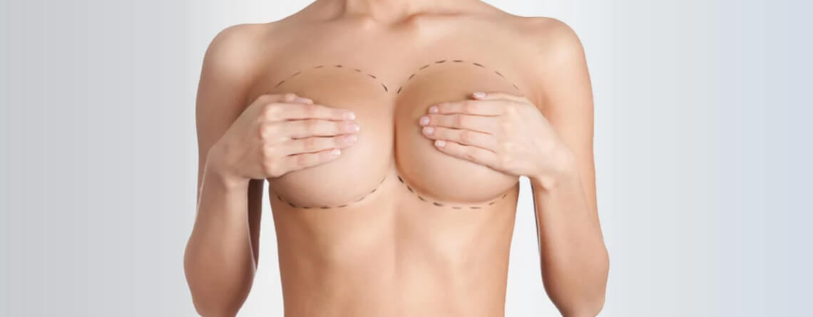 What to Expect After Your Breast Reduction Surgery?Med Esthetiks