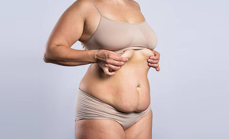 What You Need to Know About Your Tummy Tuck Procedure Recovery?