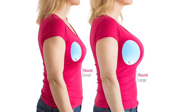 Smaller breast augmentations smaller breast implants