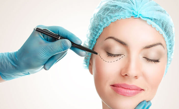 Upper eyelid surgery in Delhi