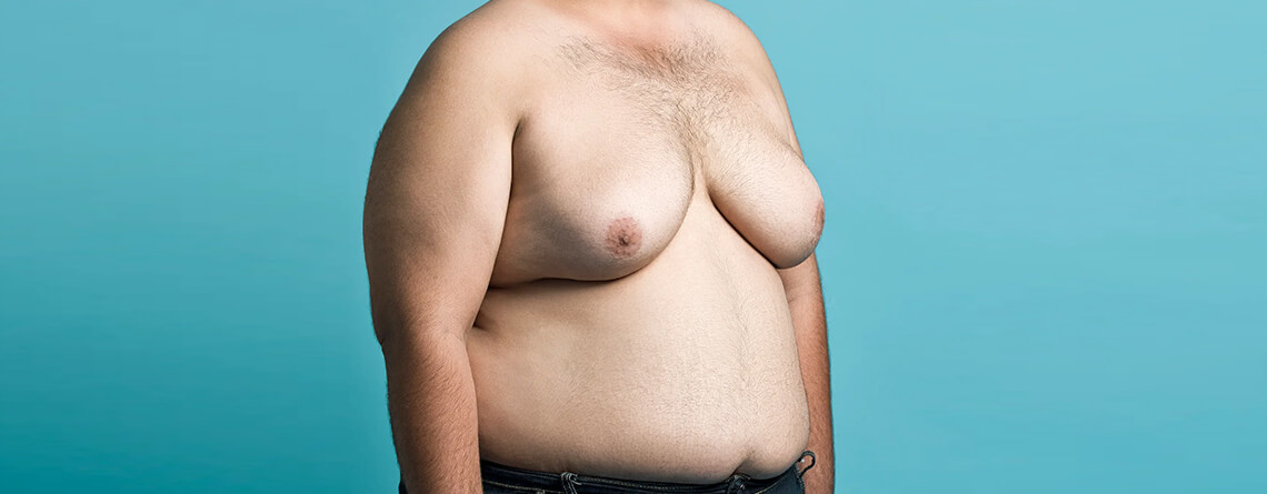 Gynecomastia Surgery