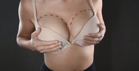 Breast Augmentation Surgery