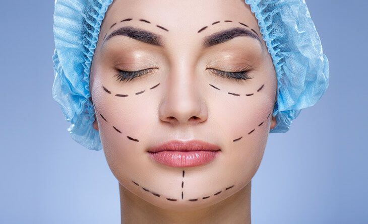 Facelift Surgery