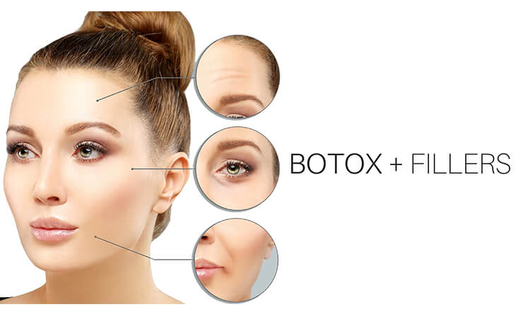 Botox Treatment