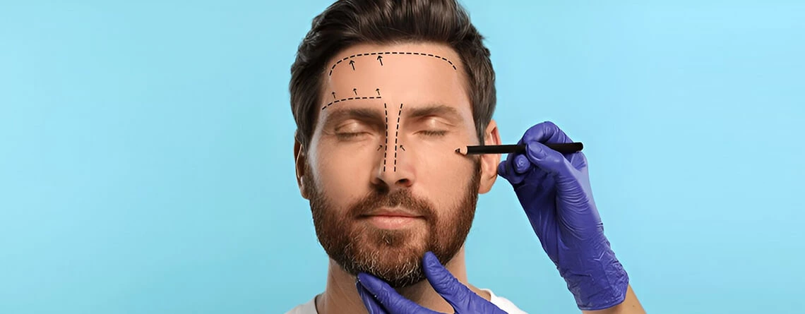 Cosmetic Surgeries for Men