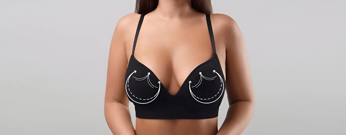 Breast reduction surgery