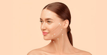 Facelift Benefits