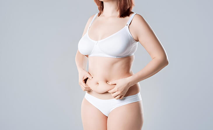 tummy tuck surgery