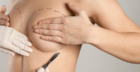 Breast reconstruction surgery