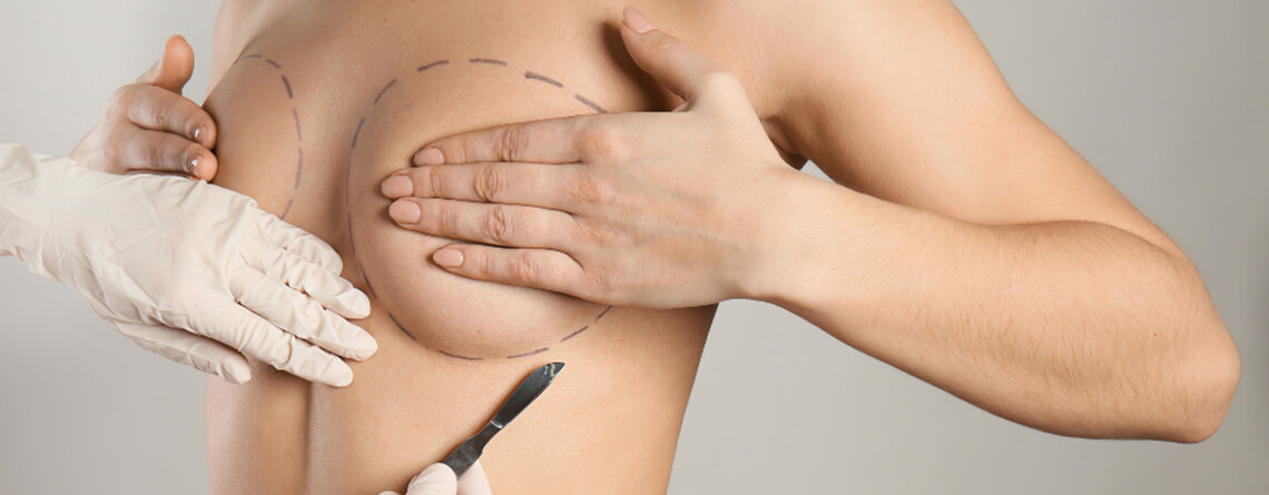 Breast reconstruction surgery
