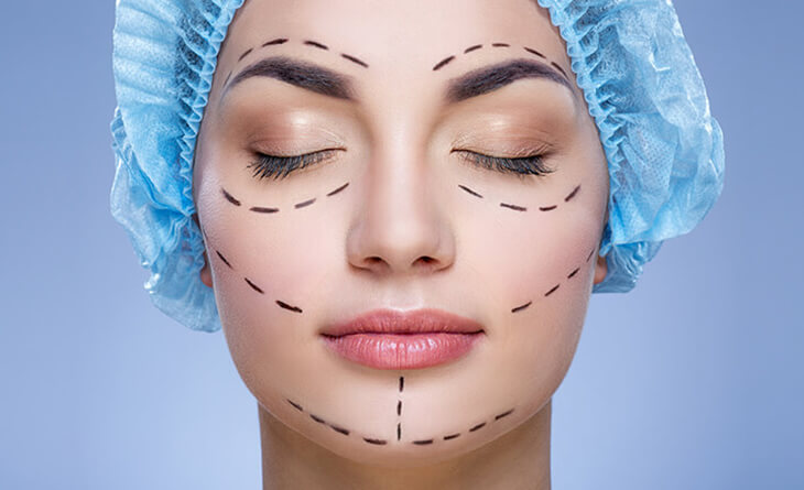 Facelift Surgery Procedure