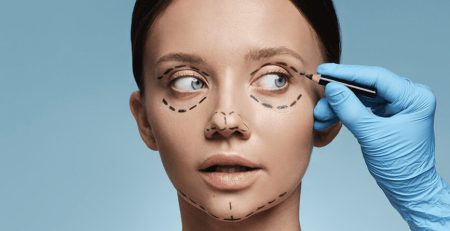 Facelift Surgery Procedure