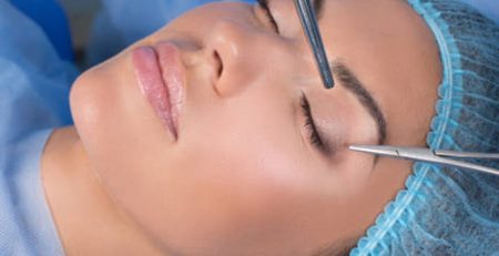 blepharoplasty surgery