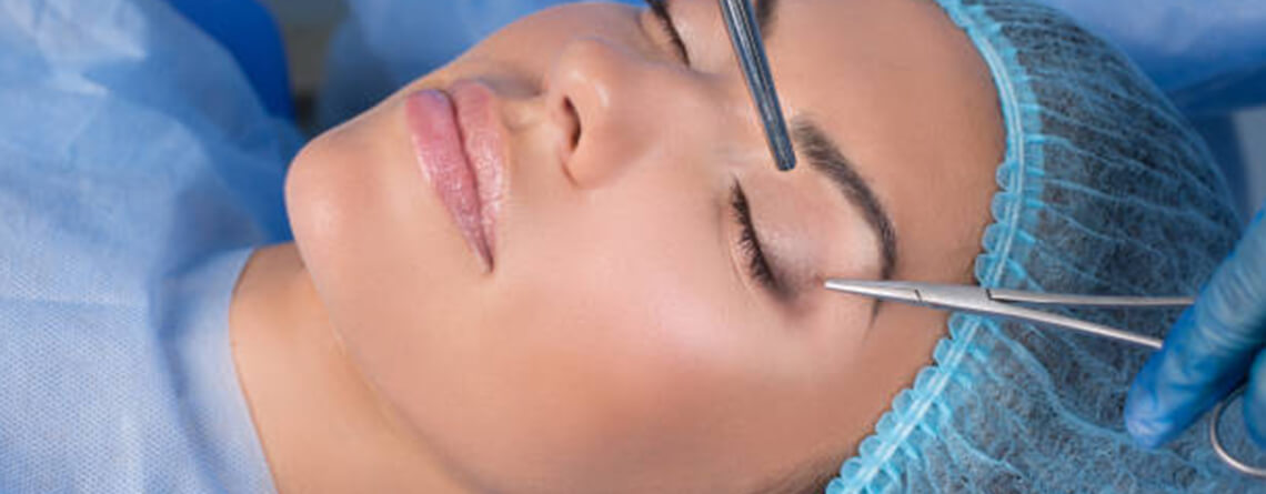 blepharoplasty surgery