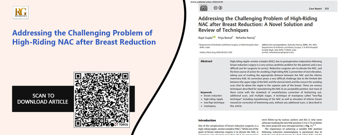 Addressing-the-Challenging-Problem-of-High-Riding-NAC-after-Breast-Reduction -01