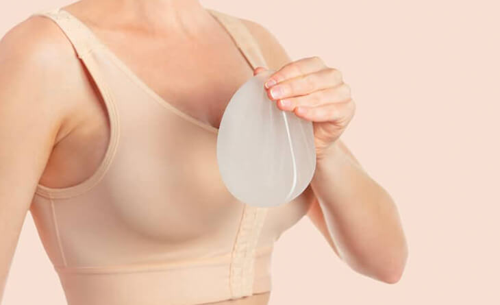 breast implant surgery