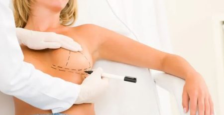 breast surgery types