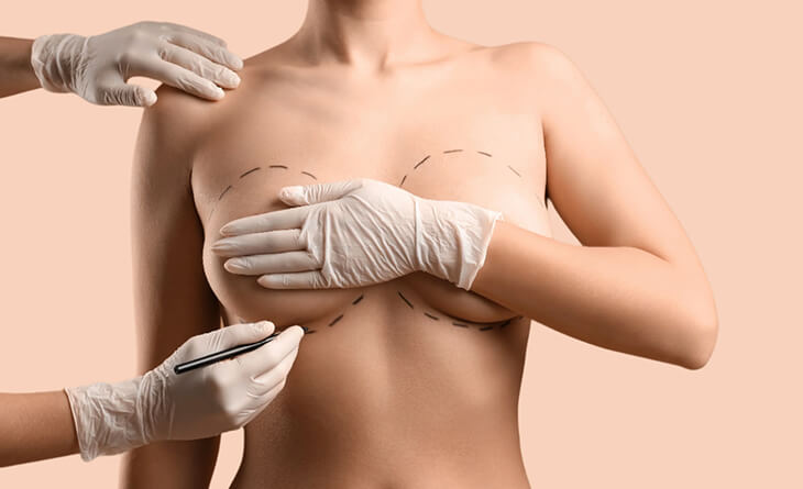 breast surgery types