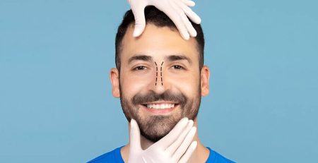 Nose job surgery