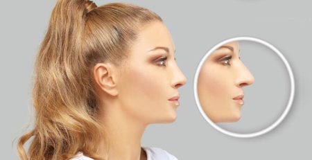 Celebrity Nose Jobs