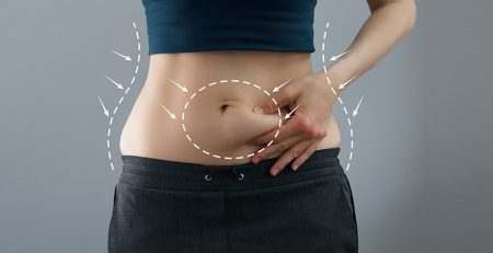 high definition abdominoplasty Delhi