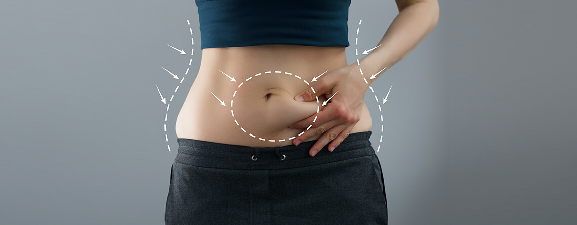 high definition abdominoplasty Delhi