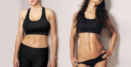 High-Definition Abdominoplasty