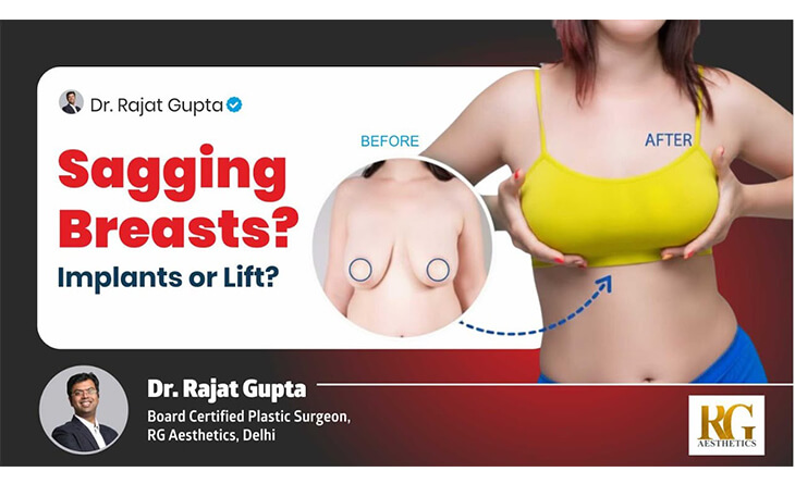 Sagging Breasts - Top-Rated Surgeons for Breast Lift Surgery in Mumbai - Dr Rajat Gupta Sagging Breasts - Top-Rated Surgeons for Breast Lift Surgery in Mumbai - Dr Rajat Gupta
