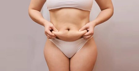 Liposuction Care After Surgery - Liposuction Surgery Cost in Delhi - Dr Rajat Gupta