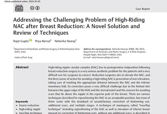 Addressing-the-Challenging-Problem-of-High-Riding-NAC-after-Breast-Reduction Addressing-the-Challenging-Problem-of-High-Riding-NAC-after-Breast-Reduction