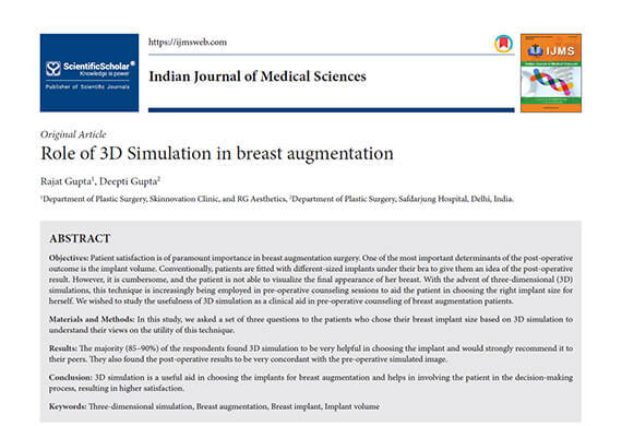 Role-of-3D-Simulation-in-breast-augmentation Role-of-3D-Simulation-in-breast-augmentation
