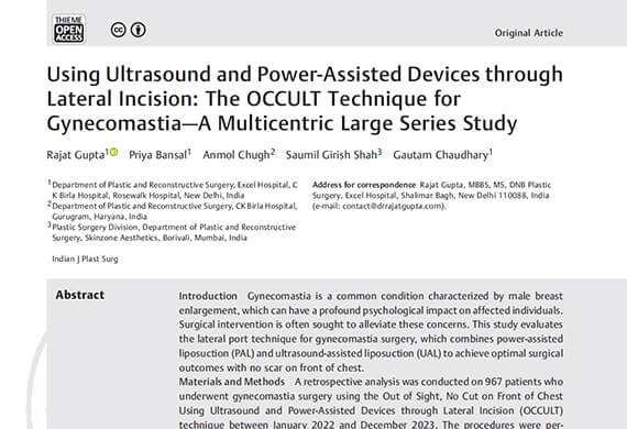Using-Ultrasound-and-Power-Assisted-Devices-through-Lateral-Incision-The-OCCULT-Technique-for-Gynecomastia Using-Ultrasound-and-Power-Assisted-Devices-through-Lateral-Incision-The-OCCULT-Technique-for-Gynecomastia