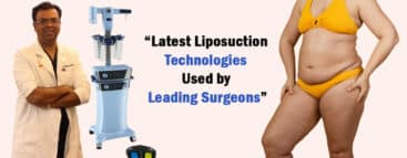 Latest Liposuction Technologies Used by Leading Surgeons - Dr Rajat Gupta