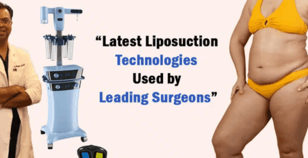 Latest Liposuction Technologies Used by Leading Surgeons - Dr Rajat Gupta