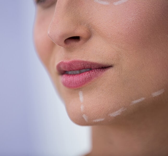 Chin Augmentation In Delhi India - Dr Rajat Gupta - RG Aesthetics - Cosmetic Plastic Surgeon