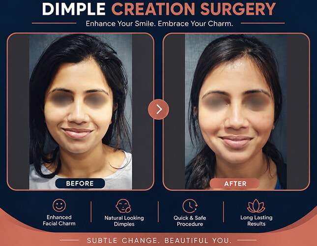 Dimple Creation Surgery Before After Result - Dr Rajat Gupta - RG Aesthetics
